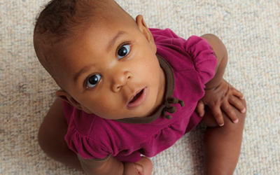 Causes of Milk Rash - Cussons Baby Nigeria
