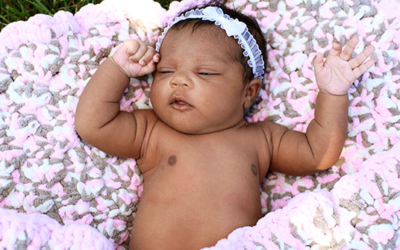 How to Care for Newborn Skin